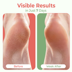 Moisturizing Heel Socks for Cracked Heels - Silicone Socks for Women and Men Foot Treatment & Overnight Hydration